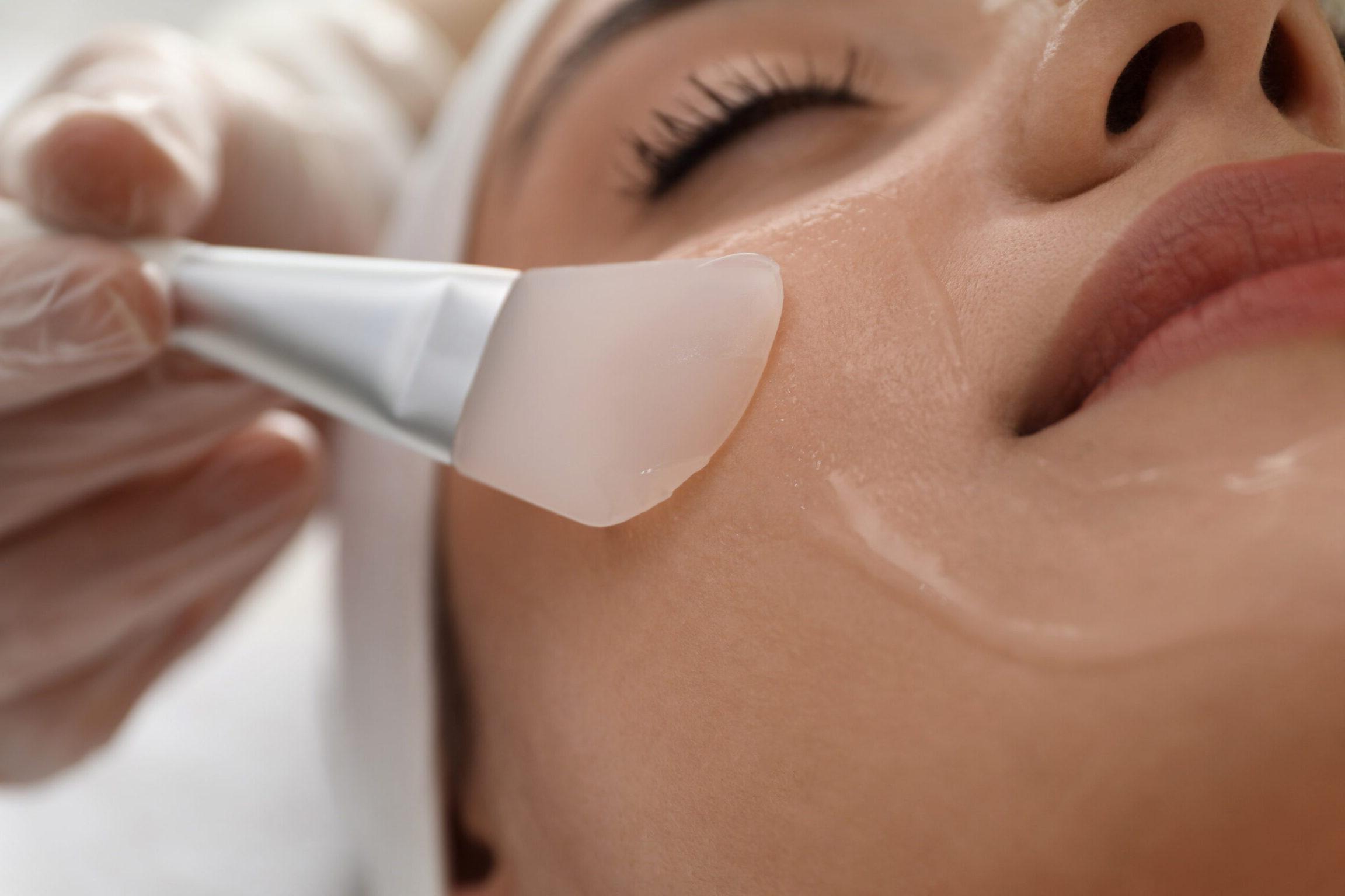 Patient receiving a chemical peel